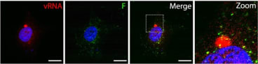 Adapted from Cifuentes-Muñoz et al. 2017; J Virol. 91(24). PMID: 28978704. Figure. BEAS-2B cells were infected with HMPV CAN97-83 at an MOI of 3 PFU/cell and fixed at 24 hpi. FISH and immunofluorescence were performed to detect vRNA (red), +RNA (purple; green as a pseudocolor), polyadenylated RNAs (red), and the HMPV F proteins (green). Bars, 10 μm. 