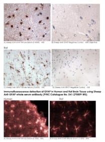 Immunohistochemical detection of GFAP in Human and Rat Brain Tissue using Sheep Anti-GFAP whole serum antibody (PINC Catalogue No. Sh1-270509-WS).