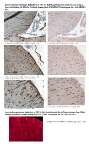 Immunohistochemical detection of CRF in Rat Hypothalamic Brain Tissue using a 1µg/ml dilution of Affinity Purified Sheep Anti-CRF (PINC Catalogue No. Sh1-051207-AP).