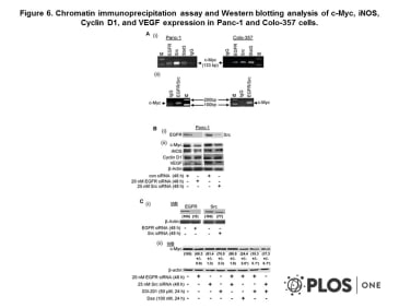 Adapted from Jaganathan et al. 2011. PLoS One. 6(5):e19605. PMID: 21573184
Figure. Chromatin immunoprecipitation assay and Western blotting analysis of c-Myc, iNOS, Cyclin D1, and VEGF expression in Panc-1 and Colo-357 cells. (A), Agarose gel electrophoresis of the Polymerase Chain Reaction (PCR)-amplified c-Myc gene fragment from the chromatin DNA precipitated with antibody against EGFR, Src, or Stat3, or with the non-specific IgG; and (B and C), Immunoblotting analysis of whole-cell lysates probing for EGFR or Src (B(i) and C(i)) or c-Myc, iNOS, Cyclin D1 or VEGF (B(ii) and C(ii)), and the effects of siRNA knockdown of EGFR (EGFR siRNA), Src (Src siRNA) or control (con) siRNA, or S3I-201 or Das). Bands corresponding to proteins or c-Myc gene in gel are shown; M, molecular weight marker, EGFR/Src, sequential immunoprecipitation with anti-EGFR and then anti-Src antibody. Data are representative of 3 independent studies, and values are mean and s.d of 3 independent studies; *p-<0.01.