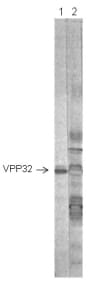 The antigen used was gradient-purified RSN-2 virus in lanes 1 and 2. First antibodies: Lane 1: anti-RSV Phosphoprotein VP32 [3-5-18] antibody; Lane 2: RS virus convalescent human sera. 

Indirect immunofluorescence: staining of RSN-2 virus infected unfixed and fixed BSC-1 cells (Gimenez et al., 1984).