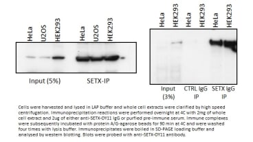 Image for Anti-Senataxin, Polyclonal [OY11]