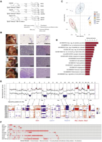 Figure 1.  
Characterization of Murine HGSOC Models

(A) Overview of murine models and the analyses conducted.

(B) Left panel: gross anatomy of the tumor distribution in the peritoneal cavity of a mouse injected with the HGS2 cell line and culled at a humane endpoint. Omental (O), mesenteric (M), and splenoportal (SP) tumor deposits are highlighted with a dashed line. A metastasis to the liver surface is indicated by an arrow. Center and right panels: tissue sections were derived from normal omenta (Bl6Ome and FVBOme) and mouse model tumors (60577, 30200, HGS1, HGS2, HGS3, and GEMM) and stained with hematoxylin and eosin (scale bars, 100 μm).

(C) Unsupervised clustering of RNA-seq sample groups by principal-component analysis.

(D) Significantly enriched Gene Ontology (GO) terms and pathways (p < 0.001) in the common 1,292 differentially expressed genes.

(E) Genomic alterations found in murine HGSOC. Copy number losses and gains are shown in blue and red, respectively. Key orthologous genes, frequently altered in human HGSOC, are indicated with blue for losses and red for gains.

(F) OncoPrint showing genes with high mutation frequency in TCGA and present in CNA regions in mouse models.
