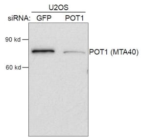 Western blot using Anti-POT1, Polyclonal [MTA40] with siRNA KD of GFP (irrelevant RNA) and POT1.