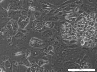 TO14 Cell Line. Image courtesy of the European Collection of Authenticated Cell Cultures (ECACC).