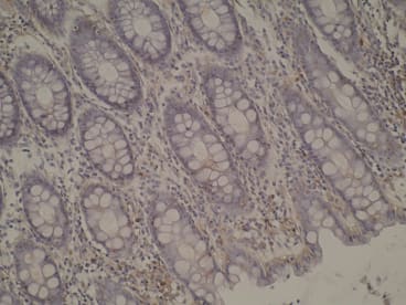 CYP4A11 normal colon mucosa