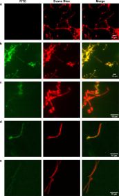 Adapted from Antoran et al., 2020. Sci Rep. 10(1):9206. PMID: 32514067. Figure: Visualization of the Ca37 monoclonal antibody-mediated recognition of Candida albicans yeast and hyphae through indirect immunofluorescence. C. albicans NCPF 3153 strain incubated (a) for 1.5 h with the Ca37 monoclonal antibody, (b) for 1.5 h with the Ca37 monoclonal antibody after treatment with 50 mM sodium metaperiodate and (c) for 18 h with the Ca37 monoclonal antibody. C. albicans ADH1 knockout strain incubated (d) for 1.5 h with the Ca37 monoclonal antibody after treatment with 50 mM sodium metaperiodate and (e) for 18 h with the Ca37 monoclonal antibody