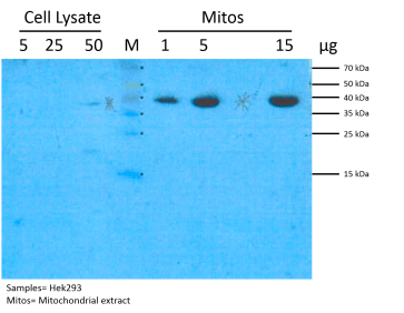 Image for Anti-mtEF-Tu