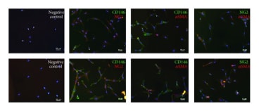 Coexpression of pericyte markers on MSCs after direct coculture with EPCs for 7 days in IMDM-FCS (top row) or IMDM-PL (bottom row). Immunofluorescence staining for CD146, NG2, and αSMA demonstrated double positive cells for each combination (CD146 and NG2, CD146 and αSMA, and NG2 and αSMA). Negative controls were stained only with the fluorescent labelled secondary antibody. Cell nuclei are stained with DAPI (blue). Scale bars = 50 μm.

Adapted from Loibl M  et al. Direct cell-cell contact between mesenchymal stem cells and endothelial progenitor cells induces a pericyte-like phenotype in vitro. Biomed Res Int 2014:395781 (2014)