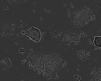 C84 Colorectal adenocarcinoma Cell Line. 4 days post plating. Image courtesy of the European Collection of Authenticated Cell Cultures (ECACC)