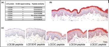 Late cornified envelope (LCE)3 protein peptide recognition pattern. (a) Affinity data of anti‐LCE3 monoclonal antibody against different LCE3 proteins based on enzyme‐linked immunosorbent assay (ELISA) analysis, and comparison of the epitope sequences in the LCE3 members. The LCE3B peptide was used for mouse immunization. (b) Immunohistochemical staining of LCE3 proteins in normal human epidermis with the developed anti‐LCE3 monoclonal antibody. The picture is representative for the expression in three different skin biopsies. (c) Staining of LCE3 proteins in normal human skin after competition with our anti‐LCE3 antibody and LCE peptides. Scale bar = 100 μm.