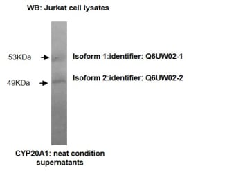 Western blotting was performed on Jurkat cell lysates using anti-CYP20A1 [Z27-P3H7*E3] Isoform 1 (53kDa) and Isoform 2 (49kDa) of Cytochrome P450 20A1 were detected.