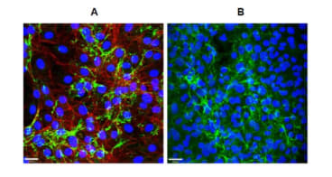 Immunofluorescence on plated cells. A: Mouse fibroblasts (NIH 3T3) stained for Emilin1 (green, clone C11A8). In red, actin cytoskeleton; in blue, nuclei. Scale bar 28 µm. B: Mouse lymphatic endothelial cells (LAEC) stained for Emilin1 (green, clone C11A8). Nuclei are in blue. Scale bar 38 µm.