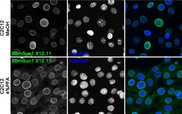 Confocal immunofluorescence images of mouse C2C12 cell line fixed with either cold methanol (MeOH)
(upper panel) or 4% paraformaldehyde (4% PFA) (lower panel) and stained with BBmSun1 X12.11
antibody. Nuclei were visualized with Hoechst. The BBmSun1 X12.11 does not detect human Sun1.