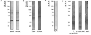 Adapted from Antoran et al., 2020. Sci Rep. 10(1):9206. PMID: 32514067. Figure: Western blotting of Candida albicans proteins recognized by Ca37 monoclonal antibody. SDS-PAGE western blotting of (a) cytosolic and (b) cell wall-associated proteins fractions of the fungus and (c) of THP-1 human monocyte cells. (d) Recognition of the Ca37 over the yeast cell wall-associated protein fraction of other Candida species. 