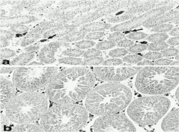 Clone 17/2 used to detect FS288 expression in fetal and adult Leydig cells by ICC. Follistatin immunoexpression was first detectable immediately after birth in the fetal generation of Leydig cells (a, day 7, arrows) and immunostaining was equally intense in the adult generation of Leydig cells when they appeared (b, day 27) and remained intense to adulthood (not shown). Source: Majdic et al. 1997. Endocrinology. 138(5):2136-47. PMID: 9112414.
