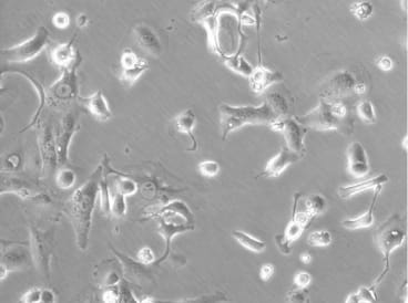 BICR 6 Cell Line. 24 hours post plating. Image courtesy of the European Collection of Authenticated Cell Cultures (ECACC)