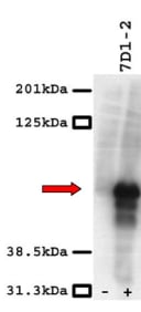 Western blot was performed using anti-Beta3 [7D1] on non-transfected (-) and transfected (+) cell lysates.