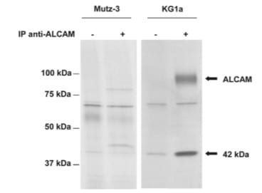 A 42 kDa protein co-precipitates with ALCAM from KG1a cells, as indicated by the arrows. KG1a and undifferentiated Mutz-3 control cells (no ALCAM expression) were incubated overnight with [35S]methionine/cysteine. ALCAM was immunoprecipitated from labeled cell lysates with 1 g of AZNL51. Samples that were incubated with protein G beads alone (–) are shown as negative controls.