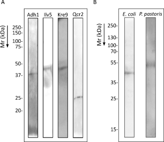 Figure 4. Western blot of Candida albicans proteins. A) Recombinant proteins obtained in Escherichia coli model. B) Comparison of the Kre9 recombinant protein obtained in Escherichia coli with that obtained in Pichia pastoris.