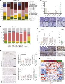 Figure 4. 
Immune Cells and Vasculature of the Murine and Human HGSOC

(A) Proportions of immune cell populations estimated from murine tumors and human omental metastases using CIBERSORT. 30200, HGS2, and HGS3, n = 4; 60577 and HGS4, n = 5; HGS1, n = 3; human omental tumors, n = 9. Median values are depicted.

(B) Flow cytometric analysis of the immune infiltrate of peritoneal tumors, close to endpoint, from mice injected with 60577, 30200, or HGS cell lines. B cells: CD45+ CD19+, CD4 cells: CD45+ CD3+ CD4+, CD8 cells: CD45+ CD3+ CD8+, monocytes: CD45+ CD11b+ Ly6C+, macrophages: CD45+, CD11b+ F4/80+ (Ly6C/G−), granulocytes: CD45+ CD11b+ Ly6G+, CD11c+ cells: CD45+ CD11b+ CD11c+ (F4/80− Ly6C/G−). A similar analysis of the immune infiltrate in the diseased omentum from patients who underwent upfront surgery is shown for comparison (HuHGS).

(C) Quantification of the number of CD3+ cells/mm2 by IHC on peritoneal tumors from mice injected with 60577, 30200, or HGS cell lines. Quantification of CD3+ cells in biopsies from patients (HuHGS) is shown for comparison. Representative images are shown; scale bars set to 100 μm.

(D) Quantification of the percentage of an area positive for F4/80 by IHC on peritoneal tumors from mice injected with 60577, 30200, or HGS cell lines. Quantification of CD68+ area in patient biopsies is included for comparison. Representative images are shown; scale bars set to 100 μm.

(E) IHC for endomucin (mouse) and CD31 (human) staining, quantified using the Definiens Tissue Studio platform with the blood vessel detection feature. Each dot represents a tumor from an individual mouse or human. Representative images for HGS2 and HuHGS are depicted at left. Scale bars, 100 μm.

(F) Heatmap illustrating Gene Ontology biological process angiogenesis gene expression across mouse models and human omental tumors.
