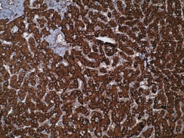 Immunohistochemistry was performed on formalin-fixed paraffin-embedded tissues. Strong cytoplasmic immunostaining is observed in normal liver using anti-CYP20A1 [Z27-P3H7*E3].