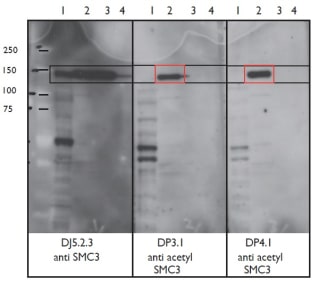 Figure. Immoblots using Anti-Acetyl SMC3 [DP3.1], Anti-Acetyl SMC3 [DP4.1] and Anti-SMC3 [DJ5.2.3]. DJ5.2.3 immunoblots all forms of SMC3 while DP3.1 and DP4.1 immunoblots only the Acetyl SMC3.