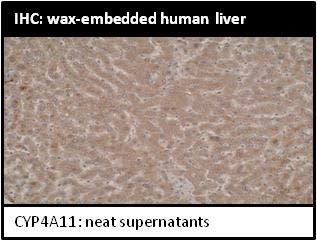 Image for Anti-Cytochrome P450 4A11 [M25-P2A10]