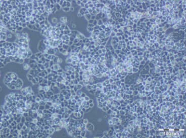 Figure 4. A2780 PTX (4). Cell Line 120 hours post plating. Ready for Subculture. 