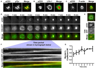 CD6 is co-transported with TCR/CD3 in microclusters toward the center of the immunological synapse formed on αCD3-containing SLBs. (A,B) Wildtype Jurkat T cells were seeded for 30 min on SLBs containing ATTO647-conjugated αCD3, and subsequently fixed and stained for immunological synapse markers. Representative TIRF microscopy images for phospho-tyrosine staining and LFA-1 staining (both labeled with Alexa488) are shown in (A,B) respectively. (C) LifeAct-GFP Jurkat T cells were seeded for 30 min on SLBs containing ATTO647-conjugated αCD3 and imaged using live cell imaging TIRF microscopy. Representative images are shown in (C). (D–G) CD6-GFP Jurkat T cells were imaged while settling on a SLB containing ATTO647-conjugated αCD3, using TIRF microscopy live cell imaging. Snap shots of every minute of the time lapse are shown in (D). Snap shots at time point 3 min, including a zoom-in of CD6-GFP and αCD3 microclusters are shown in (E). Kymograph of the line (indicated in the Merge image at time point 4 min in D) during 3:45 to 6:12 min of the imaging period is shown in (F). Co-localization over time starting at time point 2 min, represented as Mander's coefficient M1 (fraction of CD6-GFP overlapping with αCD3) in the central zoomed-in region indicated in (E) is shown in (G). Scale bars represent 10 μm. Taken from Meddens MBM, Mennens SFB, Celikkol FB, Te Riet J, Kanger JS, Joosten B, Witsenburg JJ, Brock R, Figdor CG, Cambi A. Biophysical Characterization of CD6-TCR/CD3 Interplay in T Cells. Front Immunol. 2018 Oct 9;9:2333. doi: 10.3389/fimmu.2018.02333. PMID: 30356797; PMCID: PMC6189472.