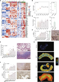 Figure 5. 
Matrisome, Matrix Index, and Stiffness of Murine and Human HGSOC

(A) Heatmap of orthologous matrisome genes, grouped by matrisome class, in the mouse and human peritoneal datasets compared to normal omenta (Student’s t test, p < 0.05).

(B) Matrix Index of murine and human peritoneal HGSOC and normal omenta. 30200, HGS2 and HGS3, n = 4; 60577 and HGS4, n = 5; HGS1 n = 3; FVBOme n = 4; Bl6Ome n = 5. For human samples, n = 9 normal/adjacent omenta and n = 9 omental tumors.

(C) Tissue modulus of murine and human peritoneal HGSOC and normal omenta. Each dot represents a tumor from an individual mouse or patient. p values correspond to the Kruskal-Wallis test for mouse data and the Mann-Whitney U test for human data.

(D) Fibroblast content of murine and human peritoneal HGSOC and normal omenta was assessed by IHC for αSMA staining and quantified using the Definiens Tissue Studio platform. p values correspond to one-way ANOVA. Each dot represents a tumor from an individual mouse. A representative image for HGS1 is depicted at right. Scale bar, 50 μm.

(E) Masson’s trichrome staining was performed on all HGSOC model tumors and on normal omenta. Bar plot illustrates the result of digital analysis and the quantification of the percentage of positive area by the Definiens Tissue Studio. Representative images for 60577 and HGS1 are depicted at right. Scale bars, 100 μm. p values correspond to one-way ANOVA. Each dot represents a tumor from an individual mouse.

(F) IHC for FN1 and VCAN staining quantified using the Definiens Tissue Studio platform. p values correspond to one-way ANOVA. Each dot represents a tumor from an individual mouse. Representative images for HGS1 are depicted at right. Scale bars, 100 μm.

(G) Construction of tissue matrisome heatmaps for models of HGSOC. Serial IHC images were color deconvoluted, overlaid, and pseudo-colored using ImageJ to highlight areas that were rich (red) or poor (black) in ECM. Expression hotspots for all six ECM molecules are shown in red, whereas areas expressing one to five ECM molecules are presented with the different colors on the key map shown at right. Scale bars, 1 mm. 
