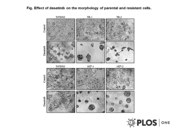 Adapted Larsen et al. 2015. PLoS One. 10(2):e0118346. PMID: 25706943 Fig. Effect of dasatinib on the morphology of parental and resistant cells.
Representative pictures of parental (T47D/S2 and T47D/S5), tamoxifen (TR-1 and TR-1) and fulvestrant (182R-1 and 182R-2) resistant cell lines treated for five days with dasatinib (1 μM) or DMSO (control).