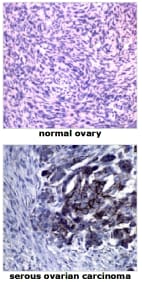 Immunohistochemistry images showing staining of formalin-fixed, paraffin-embedded human tissue sections using Anti-Cytochrome P450 1B1 [5D3]