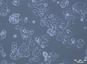 Figure 4: A2780 PTX (64) Cell Line. 120 hours after plating. Ready for subculture.