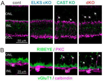 Increased occurrence of ectopic ribbon synapses in CAST KO and dKO retinae. (A and B) Representative confocal images of immunolabeled retinal sections, showing distribution
of presynaptic proteins (RIBEYE in A, vGluT1 in B; green) with respect to BCs (PKC; magenta; A) and HCs (calbindin; magenta; B). Ectopically localized synapses in the ONL of CAST KO and dKO retinae (indicated by white arrows). Bars, 50 µm in A; 20 µm in B. 

Adapted from Hagiwara et al, J. Cell Biol. 2018 Vol. 217 No. 11 3993–4006