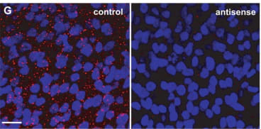 Adapted from Pearson RA, Lüneborg NL, Becker DL, Mobbs P. Gap junctions modulate interkinetic nuclear movement in retinal progenitor cells. J Neurosci. 2005 Nov 16;25(46):10803-14. doi: 10.1523/JNEUROSCI.2312-05.2005. PMID: 16291954; PMCID: PMC6725838.The effects of gap-junction blockers on interkinetic nuclear movement. G, Cx43 staining (red) in controls (left) and after application of Cx43 asODNs (right). The preparations were counterstained with Hoechst 33342 (blue) to label the nuclei. Images are projections of 10 confocal sections taken at 1 μm steps through the ventricular zone of each retinal preparation. For additional details of the extent of connexin knockdown, see Materials and Methods. Scale bar, 10 μm.