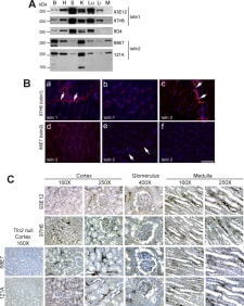 Adapted from Praekelt U, Kopp PM, Rehm K, Linder S, Bate N, Patel B, Debrand E, Manso AM, Ross RS, Conti F, Zhang MZ, Harris RC, Zent R, Critchley DR, Monkley SJ. New isoform-specific monoclonal antibodies reveal different sub-cellular localisations for talin1 and talin2. Eur J Cell Biol. 2012 Mar;91(3):180-91. doi: 10.1016/j.ejcb.2011.12.003. Epub 2012 Feb 3. PMID: 22306379; PMCID: PMC3629562. Expression of talin1 and talin2 in various mouse tissues and their immuno-localisation in muscle and kidney. (A) Western blot of whole tissue lysates (40 μg protein) probed with the talin1- or talin2-specific antibodies shown. Tissues: B, brain; H, heart; S, spleen; K, kidney; Lu, lung; Li, liver; M, skeletal muscle. (B) Cryo-sections of gastrocnemius muscle were immunostained with Mab 97H6 directed against talin1 (a and b) and Mab 68E7 against talin2 (c–f). Talin1 was mostly localised to the myotendinous junction (MTJ) (arrows in a), with weaker staining of costameres (b), while talin2 staining was strong at both MTJ (arrows in c) and costameres (d). In talin2-null muscle, no staining was detected at the MTJ (arrows in e) or at costameres (f). Scale bar = 50 μm. (C) Immuno-staining of paraffin-embedded sections of wild type and talin2 null mouse kidney with antibodies to talin1 (93E12 and 97H6) and talin2 (68E7 and 121A). Staining is present in the glomerulus, tubules and interstitium in the cortex, and the tubules and interstitium in the medulla. There was no staining for talin2 in kidneys from Tln2-null mice.