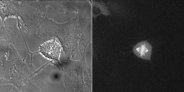 Cyclin B1-Venus Reporter Cell line [RPE1 cycB1-venus/+ KI clone 20G11] Metaphase, example 2