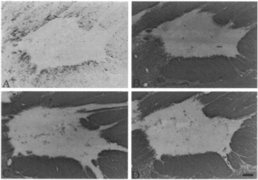 Clone MBP 14 used to detect myelinated structures in MS plaques by IHC-P. C: Clone 14 recognized all myelinated structures. Source: Matsuo et al. 1997. Am J Pathol. 150(4):1253-66. PMID: 9094982.
