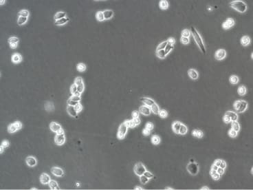 A2780ADR Cell Line. 24 hours post plating. Image courtesy of the European Collection of Authenticated Cell Cultures (ECACC)