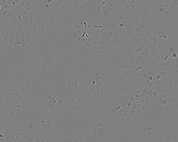 1-7 HB2 Cell Line. 24 hours post plating. Image courtesy of the European Collection of Authenticated Cell Cultures (ECACC).