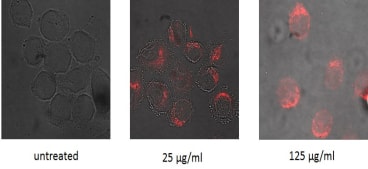 Microscopy images of HeLa S3 cells treated with MC51 at the indicated concentrations. Images show overlay of brightfield and confocal fluorescence (excitation 458nm; emission longpass 560nm filter) fields.