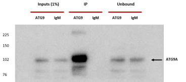 IP Conditions:

HEK293A cells. 1x15 cm dish.
Cells lysed in  800 μl TNTE buffer (20 mM Tris pH 7.4, 150 mM NaCl, 5 mM EDTA and 0.4% Triton X-100) + protein inhibitors cocktail.
Pi done using 10 μg of anti-ATG9A 14f2 8B1 antibody coupled to 50 μl of Protein A Dynabeads.
o/n incubation of lysate with beads at 4°C.
Elution with 50 μl SB 1x and 25 μl loaded for SDS-PAGE.

Western blot:

Blocking: 1x PBST with 5% non-fat dry milk
Primary Ab dilution: Rabbit Anti ATG9A (STO215) 1/1000 in 1x PBST with 5% non-fat dry milk
Secondary Ab dilution: HRP-Anti rabbit 1/5000 in 1x PBST with 5% non-fat dry milk
