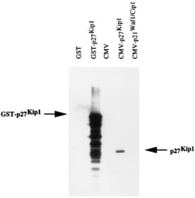 Immunoblotting to show the specificity of anti-p27kip1 mAb SX18F7. SX18F7 can specifically recognize the 50-kDa GST-p27kip1 fusion protein (indicated by arrow GST–p27kip1) but not GST. In transfected Saos-2 cells, SX18F7 can specifically react with 27-kDa p27kip1 (indicated by arrow p27kip1) expressed from CMV–p27kip1 plasmid. It does not crossreact with p21waf1/cip1 overexpressed from CMV–p21waf1/cip1 plasmid.