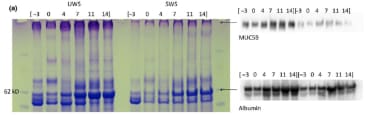 Adapted from van Leeuwen et al. 2018. Oral Dis; 24(6):972-982. PMID: 29637662. Figure. Coomassie Brilliant Blue (CBB)-  and Periodic Acid- Schiff (PAS)- stained gel and Western blots for MUC5B and albumin of one representative patient.
