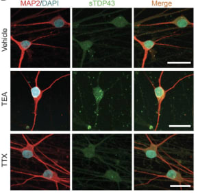 Figure published: Weskamp K, Tank EM, Miguez R, McBride JP, Gómez NB, White M, Lin Z, Moreno Gonzalez C, Serio A, Sreedharan J, Barmada SJ. Shortened TDP43 isoforms upregulated by neuronal hyperactivity drive TDP43 pathology in ALS. Journal of Clinical Investigation. First online 2019 Nov 12. pii: 130988.