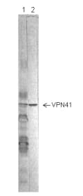 Image for Anti-RSV Nucleoprotein VP41 [4-18]