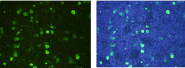 Immunofluorescence on transfected 293T cells using anti-SCL [1C10]. DAPI (nucleus stain) is shown in blue.