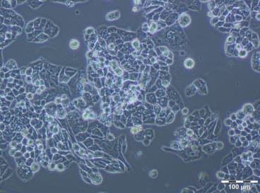 Figure 4. A2780 PTX (16) Cell Line. 120 hours after plating. Ready for subculture. Reprinted from Szenajch J. et al. 2020. Int. J. Mol. Sci. 21(23): 9218. 