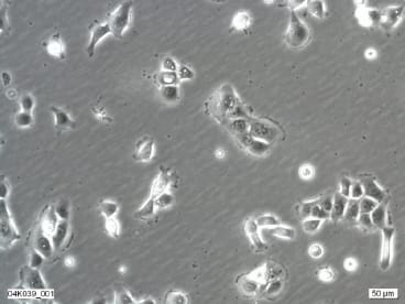 BICR 22 Cell Line. Image courtesy of the European Collection of Authenticated Cell Cultures (ECACC)